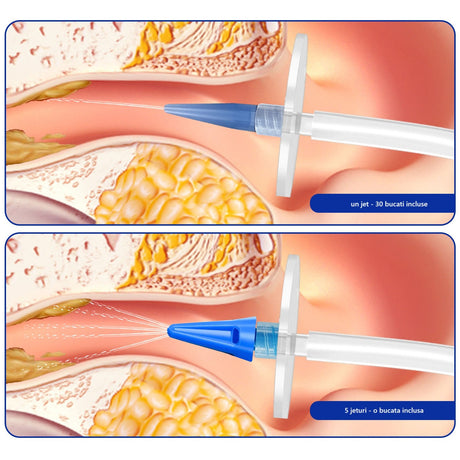 Dispozitiv de Curatare Urechi, Vivimall, pentru Indepartare Ceara, Accesorii Incluse, din ABS+PC, Verde - vivimall.ro