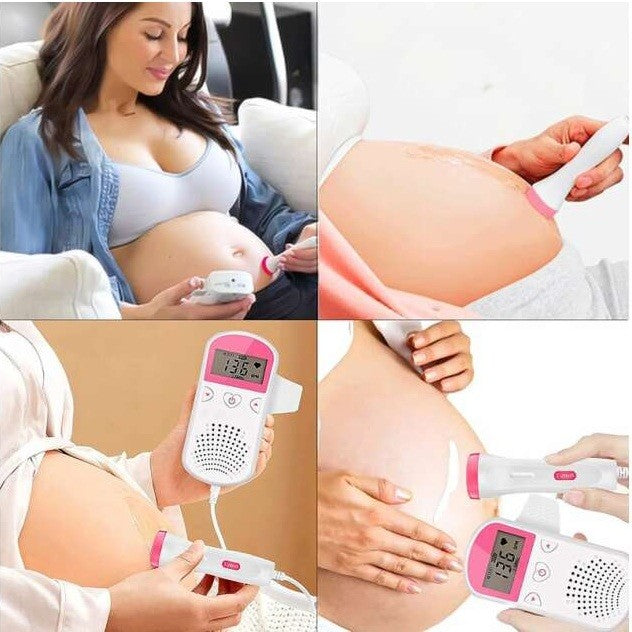 Monitor Fetal Doppler, Monitorizare Sarcina, Ritm Cardiac, Ecran Lcd 4.5 Cm, 2 X Baterii Aa (Neincluse), Portabil, Din Abs, Utilizare De La 9 Saptamani