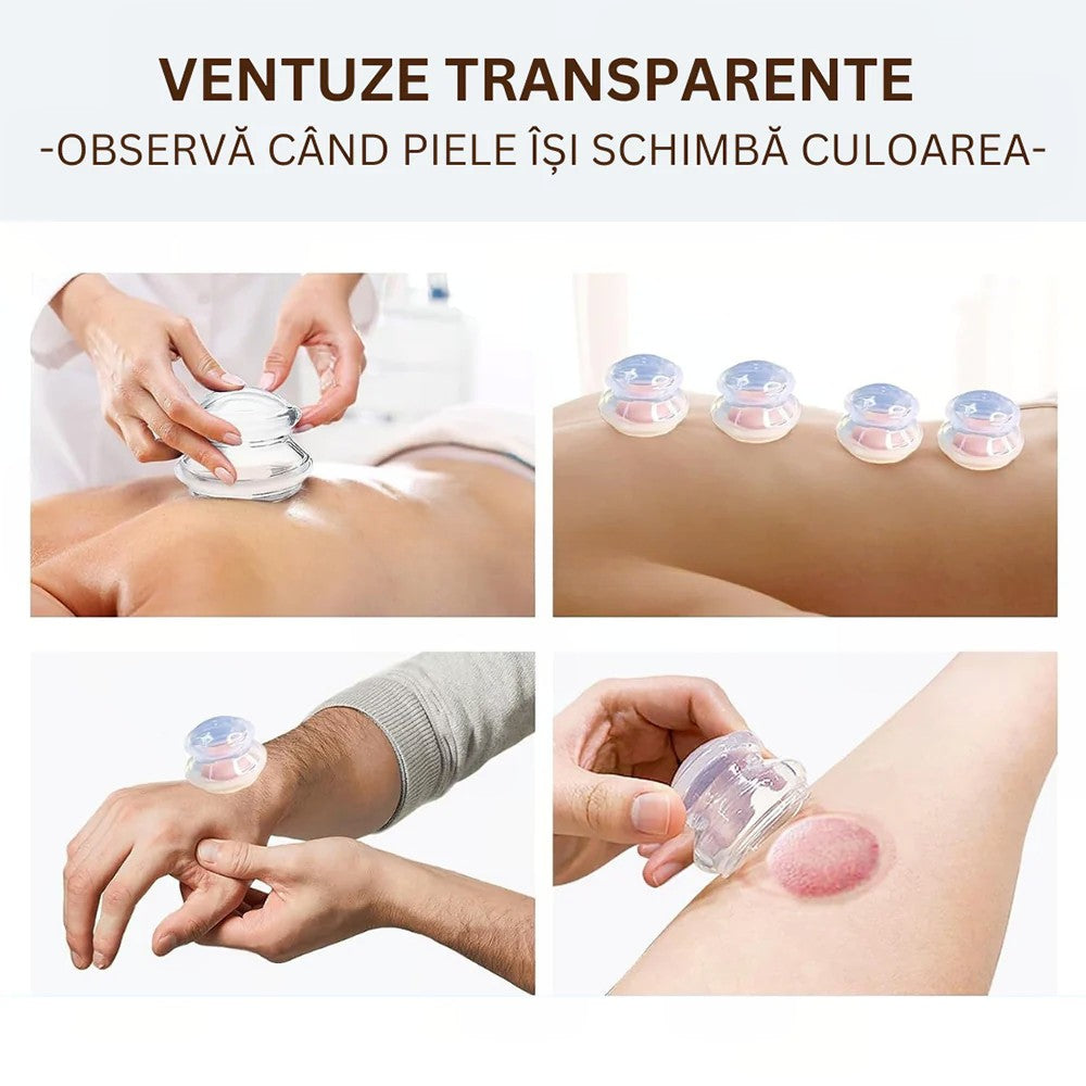 Set 4 Ventuze De Cupping, Pentru Masaj Anticeluluitic, Din Silicon, Alb - vivimall.ro